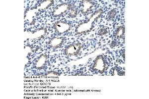 Rabbit Anti-KRT18 Antibody  Paraffin Embedded Tissue: Human Lung Cellular Data: Alveolar cells Antibody Concentration: 4. (Cytokeratin 18 Antikörper  (N-Term))