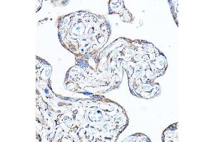 Immunohistochemistry (IHC) image for anti-Pyruvate Dehydrogenase Kinase, Isozyme 4 (PDK4) (AA 102-411) antibody (ABIN6145396)