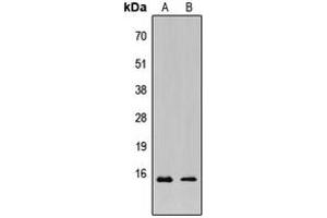 Western blot analysis of KCNE1L expression in HeLa (A), MCF7 (B) whole cell lysates.