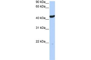 WB Suggested Anti-KRT23 Antibody Titration:  0. (KRT23 Antikörper  (Middle Region))