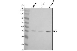 Western blot analysis of MC5R using anti-MC5R antibody (ABIN7825530).