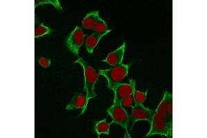 Immunofluorescence (IF) image for anti-Keratin 8 (KRT8) antibody (ABIN6939880)