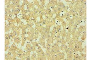 Immunohistochemistry of paraffin-embedded human liver tissue using ABIN7149891 at dilution of 1:100 (DKK4 Antikörper  (AA 19-224))