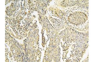 IHC analysis of CPAMD8 using anti-CPAMD8 antibody (ABIN6719649). (CPAMD8 Antikörper  (AA 58-234))