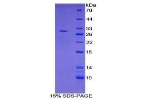 SDS-PAGE analysis of Human PIAS1 Protein. (PIAS1 Protein)