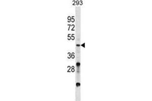 VSX2 Antibody (C-term) western blot analysis in 293 cell line lysates (35 µg/lane). (VSX2 Antikörper  (C-Term))