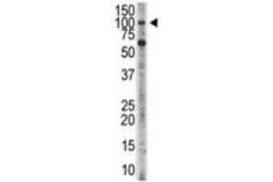 Western Blotting (WB) image for anti-Hexokinase 3 (White Cell) (HK3) antibody (ABIN3003707) (HK3 Antikörper)