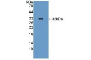 Detection of Recombinant GLRX3, Mouse using Polyclonal Antibody to Glutaredoxin 3 (GLRX3) (GLRX3 Antikörper  (AA 73-320))