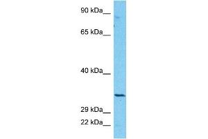 Host:  Rabbit  Target Name:  CBR3  Sample Type:  COLO205 Whole Cell lysates  Antibody Dilution:  1. (CBR3 Antikörper  (Middle Region))