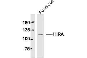 Mouse pancreas lysates probed with HIRA Polyclonal Antibody, Unconjugated  at 1:300 dilution and 4˚C overnight incubation. (HIRA Antikörper  (AA 251-350))
