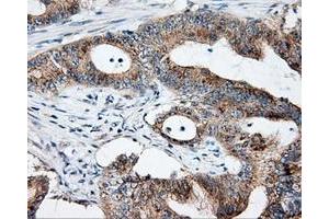 Immunohistochemical staining of paraffin-embedded Kidney tissue using anti-NME4 mouse monoclonal antibody. (NME4 Antikörper)