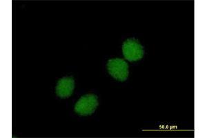 Immunofluorescence of purified MaxPab antibody to CHKB on HeLa cell. (CHKB Antikörper  (AA 1-395))
