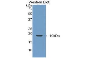 Western Blotting (WB) image for anti-Angiopoietin 1 (ANGPT1) (AA 284-452) antibody (ABIN1857989) (Angiopoietin 1 Antikörper  (AA 284-452))