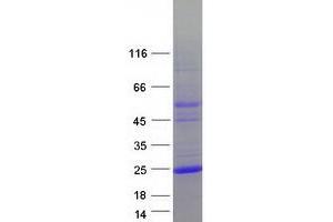 Western Blotting (WB) image for L Antigen Family, Member 3 (LAGE3) protein (Myc-DYKDDDDK Tag) (ABIN2724469)