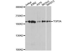 Western blot analysis of extracts of various cell lines, using TOP2A antibody. (Topoisomerase II alpha Antikörper)