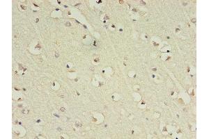 Immunohistochemistry of paraffin-embedded human brain tissue using ABIN7153483 at dilution of 1:100 (GABRA4 Antikörper  (AA 36-258))