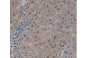 #VALUE! (Centriolin Antikörper  (AA 2101-2325))