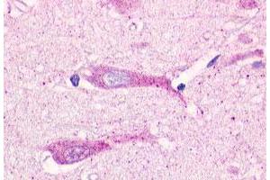 Immunohistochemical staining of human brain, neurons and glia with GPR19 polyclonal antibody .