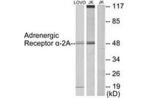 Western blot analysis of extracts from Jurkat/LOVO cells, using Adrenergic Receptor alpha-2A Antibody. (ADRA2A Antikörper  (AA 331-380))