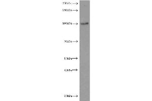 Western Blotting (WB) image for anti-Luteinizing Hormone/Choriogonadotropin Receptor (LHCGR) antibody (ABIN2937954) (LHCGR Antikörper)
