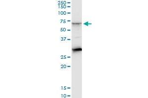 CTNS monoclonal antibody (M09), clone 5G6. (CTNS Antikörper  (AA 1-100))