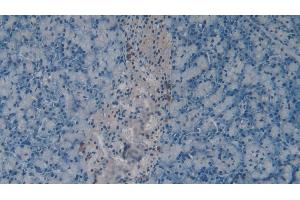 Detection of CHEM in Mouse Pancreas Tissue using Polyclonal Antibody to Chemerin (CHEM) (CHEM (AA 21-155) Antikörper)