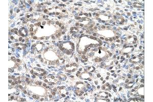 Immunohistochemistry (IHC) image for anti-Deafness, Autosomal Dominant 5 (DFNA5) (C-Term) antibody (ABIN310772) (DFNA5 Antikörper  (C-Term))