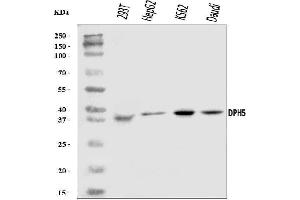 Western blot analysis of DPH5 using anti-DPH5 antibody (ABIN7599711). (DPH5 Antikörper  (AA 11-250))