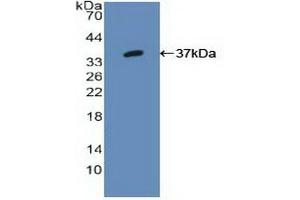 Detection of Recombinant IRF1, Human using Polyclonal Antibody to Interferon Regulatory Factor 1 (IRF1) (IRF1 Antikörper  (AA 11-276))