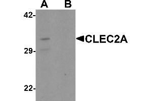 Western blot analysis of CLEC2A in K562 cell lysate with CLEC2A antibody at 1 µg/mL in (A) the absence and (B) the presence of blocking peptide.