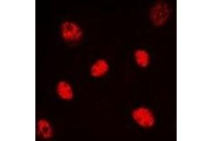 Immunofluorescent analysis of HNF4 alpha/gamma staining in HeLa cells. (HNF4 alpha/gamma Antikörper)
