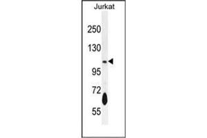 Western blot analysis of PDE3B Antibody (Center) in Jurkat cell line lysates (35ug/lane). (PDE3B Antikörper  (Middle Region))