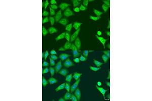 Immunofluorescence analysis of U2OS cells using PKR/PKR/EIF2 antibody (ABIN1679688 and ABIN3018462) at dilution of 1:100. (EIF2AK2 Antikörper)