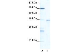 WB Suggested Anti-HSF4 Antibody Titration:  5. (HSF4 Antikörper  (Middle Region))