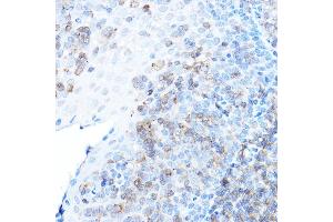 Immunohistochemistry of paraffin-embedded human tonsil using ULBP1 Rabbit pAb (ABIN6128898, ABIN6149917, ABIN6149918 and ABIN6214755) at dilution of 1:500 (40x lens). (ULBP1 Antikörper  (AA 26-216))
