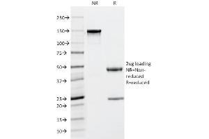SDS-PAGE Analysis Purified Tryptase Mouse Monoclonal Antibody (TPSAB1/1963). (TPSAB1 Antikörper  (AA 115-233))