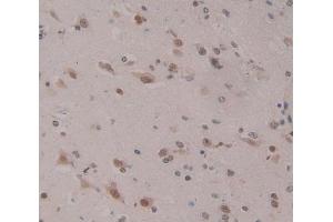 Used in DAB staining on fromalin fixed paraffin- embedded Kidney tissue (HOPX Antikörper  (AA 10-73))