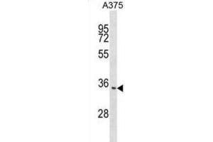 Western Blotting (WB) image for anti-Integral Membrane Protein 2C (ITM2C) antibody (ABIN2999274)