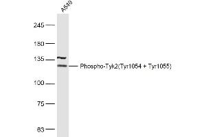 A549 lysates probed with Phospho-Tyk2(Tyr1054 + Tyr1055) Polyclonal Antibody, Unconjugated  at 1:500 dilution and 4˚C overnight incubation. (TYK2 Antikörper  (pTyr1054, pTyr1055))
