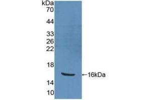 Detection of Recombinant PPARg, Human using Polyclonal Antibody to Peroxisome Proliferator Activated Receptor Gamma (PPARg) (PPARG Antikörper  (AA 157-274))