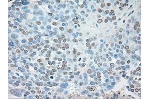Immunohistochemical staining of paraffin-embedded Kidney tissue using anti-USP13mouse monoclonal antibody. (USP13 Antikörper)