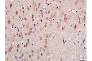 Immunohistochemistry (Paraffin-embedded Sections) (IHC (p)) image for anti-Gonadotropin-Releasing Hormone Receptor (GNRHR) (AA 201-328) antibody (ABIN686917)