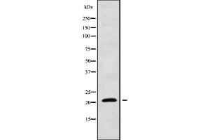 Western blot analysis of CYBA using HeLa whole cell lysates (CYBA Antikörper  (N-Term))