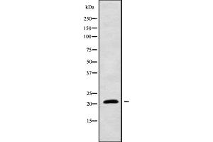 Western blot analysis of CYBA using HeLa whole cell lysates
