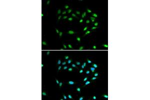 Immunofluorescence analysis of A549 cell using SIRT1 antibody. (SIRT1 Antikörper)