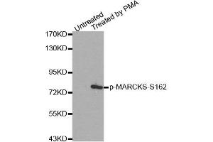 Western Blotting (WB) image for anti-Myristoylated Alanine-Rich Protein Kinase C Substrate (MARCKS) (pSer162) antibody (ABIN1870417) (MARCKS Antikörper  (pSer162))