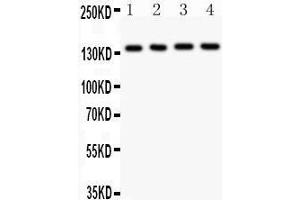 Anti- ABCB4 Picoband antibody, Western blotting All lanes: Anti ABCB4  at 0. (ABCB4 Antikörper  (AA 601-720))