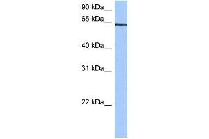 TTC6 antibody used at 0. (TTC6 Antikörper  (C-Term))