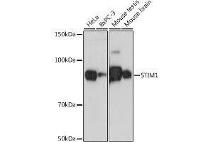 Western blot analysis of extracts of various cell lines, using STIM1 antibody (ABIN7270609) at 1:500 dilution. (STIM1 Antikörper)