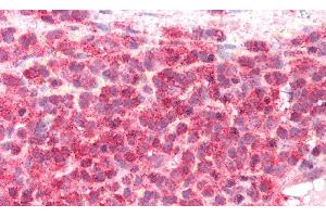 Immunohistochemistry (IHC) image for anti-Inducible T-Cell Co-Stimulator Ligand (ICOSLG) (AA 23-249) antibody (ABIN7439975)